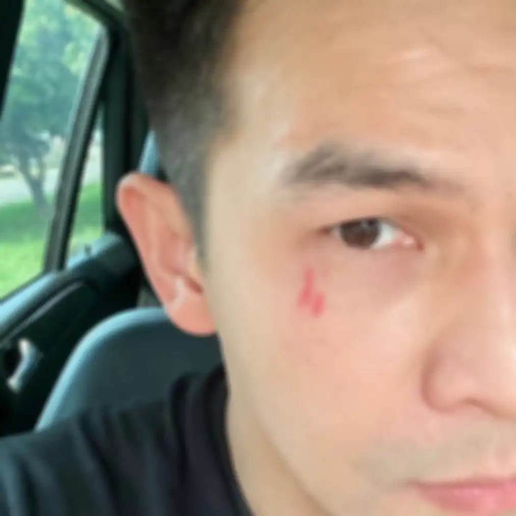 Dalam foto yang diunggah paman Ijonk terlihat Dhena Devanka seperti sedang menghajar Jonathan Frizzy. Dhena Devanka buka suara. 