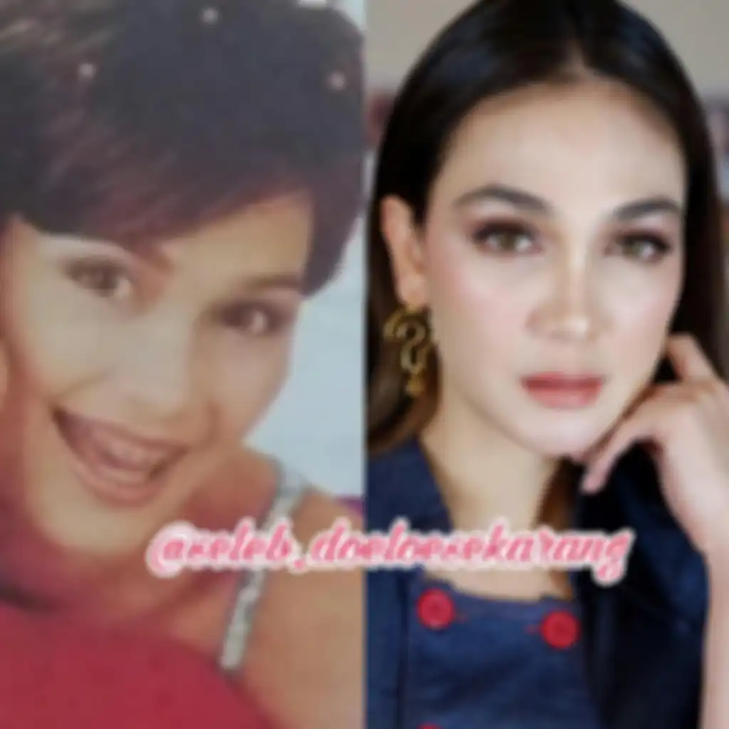 Tampilan Jadul Luna Maya Pakai Behel
