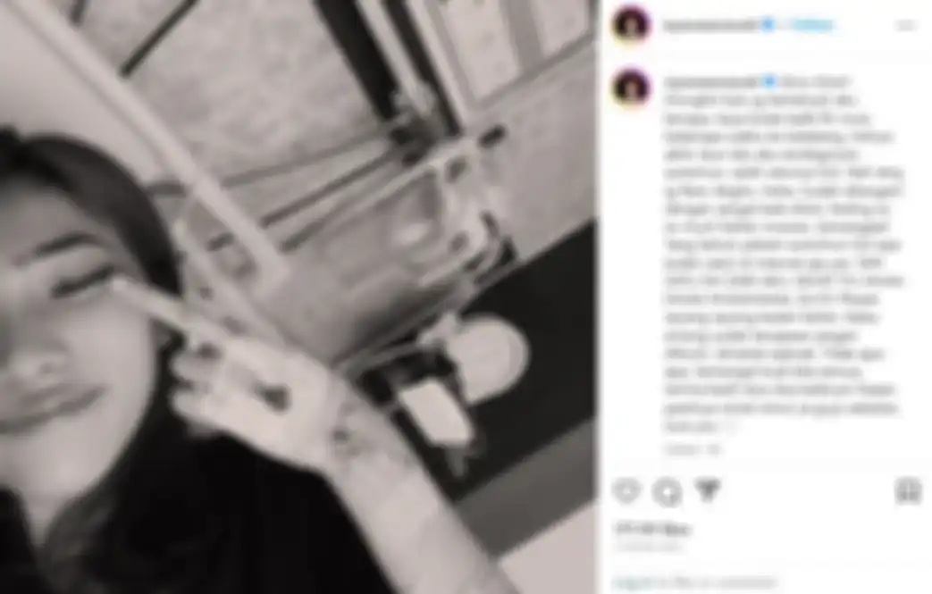 Isyana Sarasvati didiagnosis mengidap penyakit autoimun 
