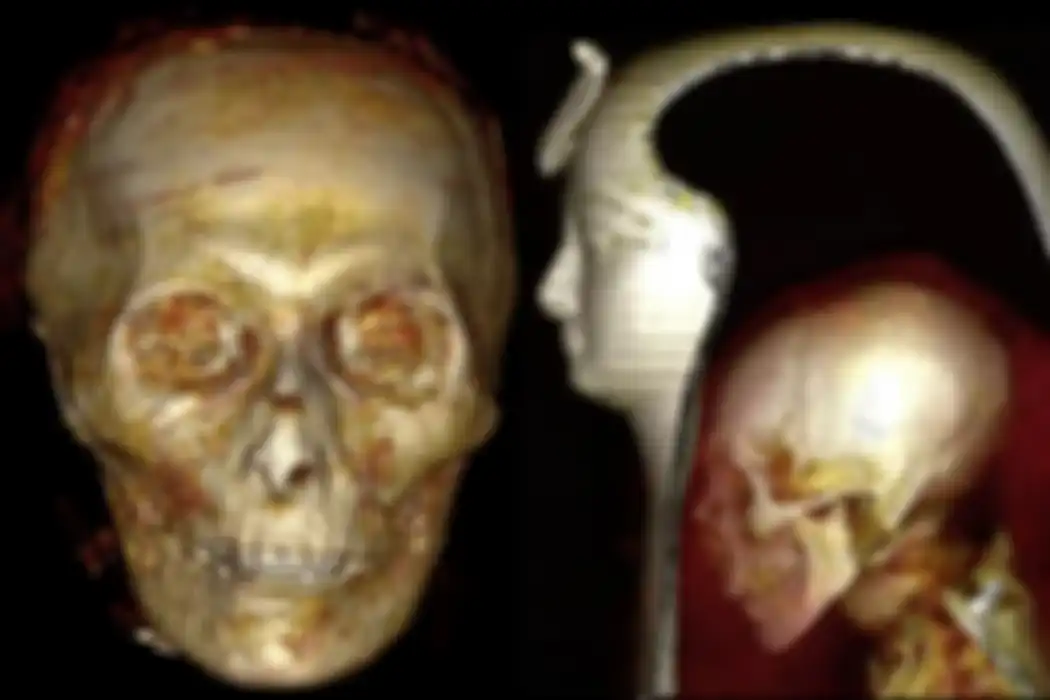 Hasil pemindaian mumi Firaun Amenhotep I