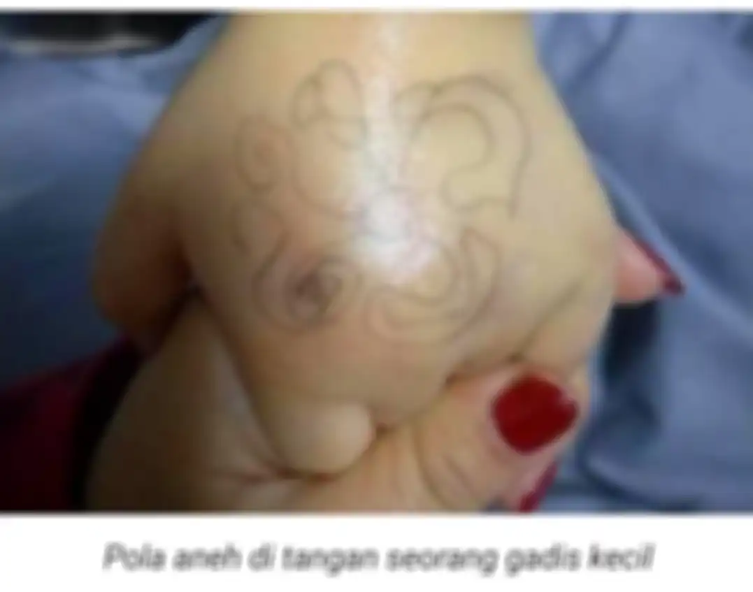 Gambar aneh ditemukan di tangan seorang gadis kecil.