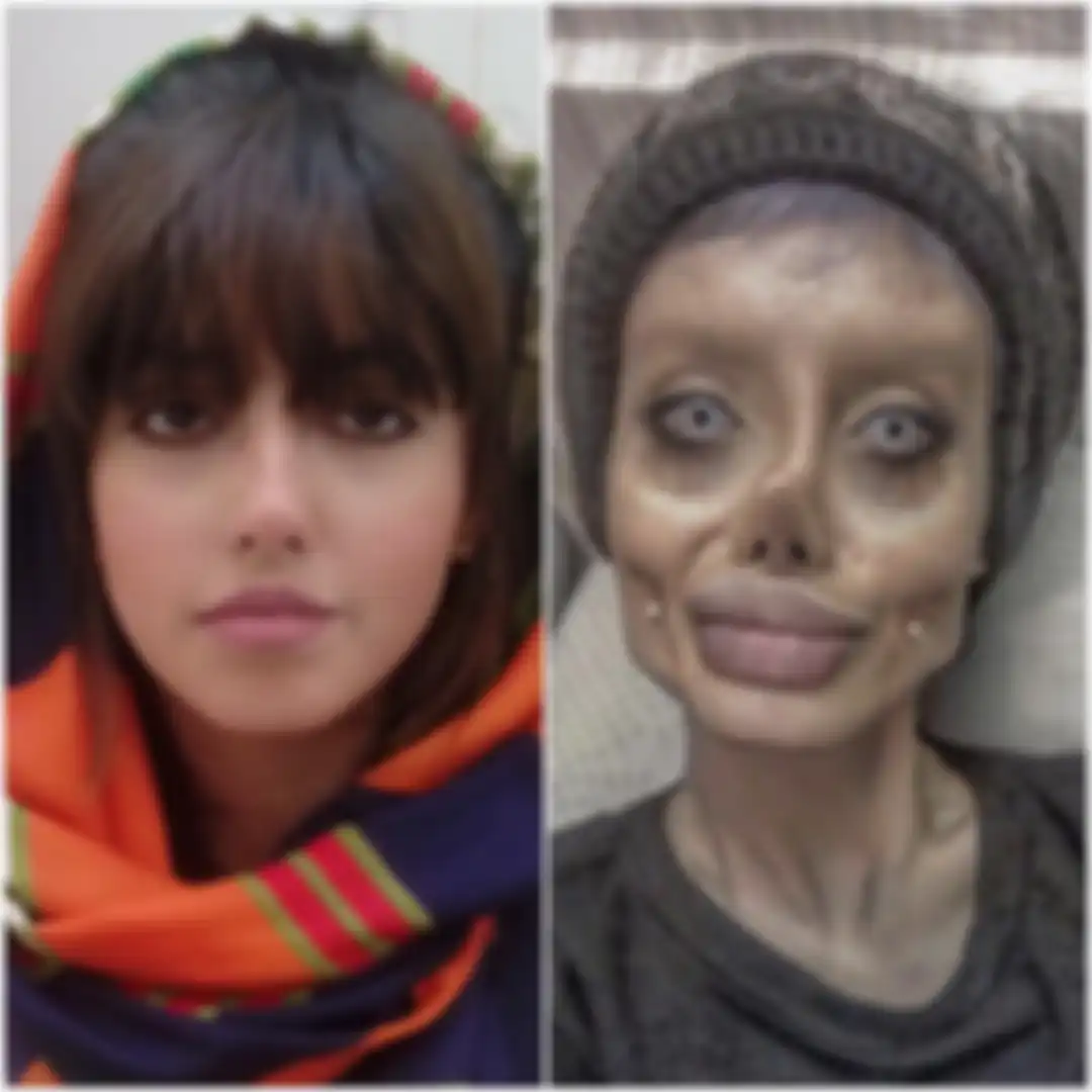 (kiri) Wajah asli Sahar Tahar sebelum operasi