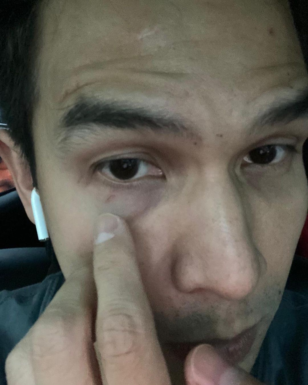 Paman Jonathan Frizzy, Benny Simanjuntak makin getol mengunggah foto bukti kekekasan Dhena Devanka di Instagram. 