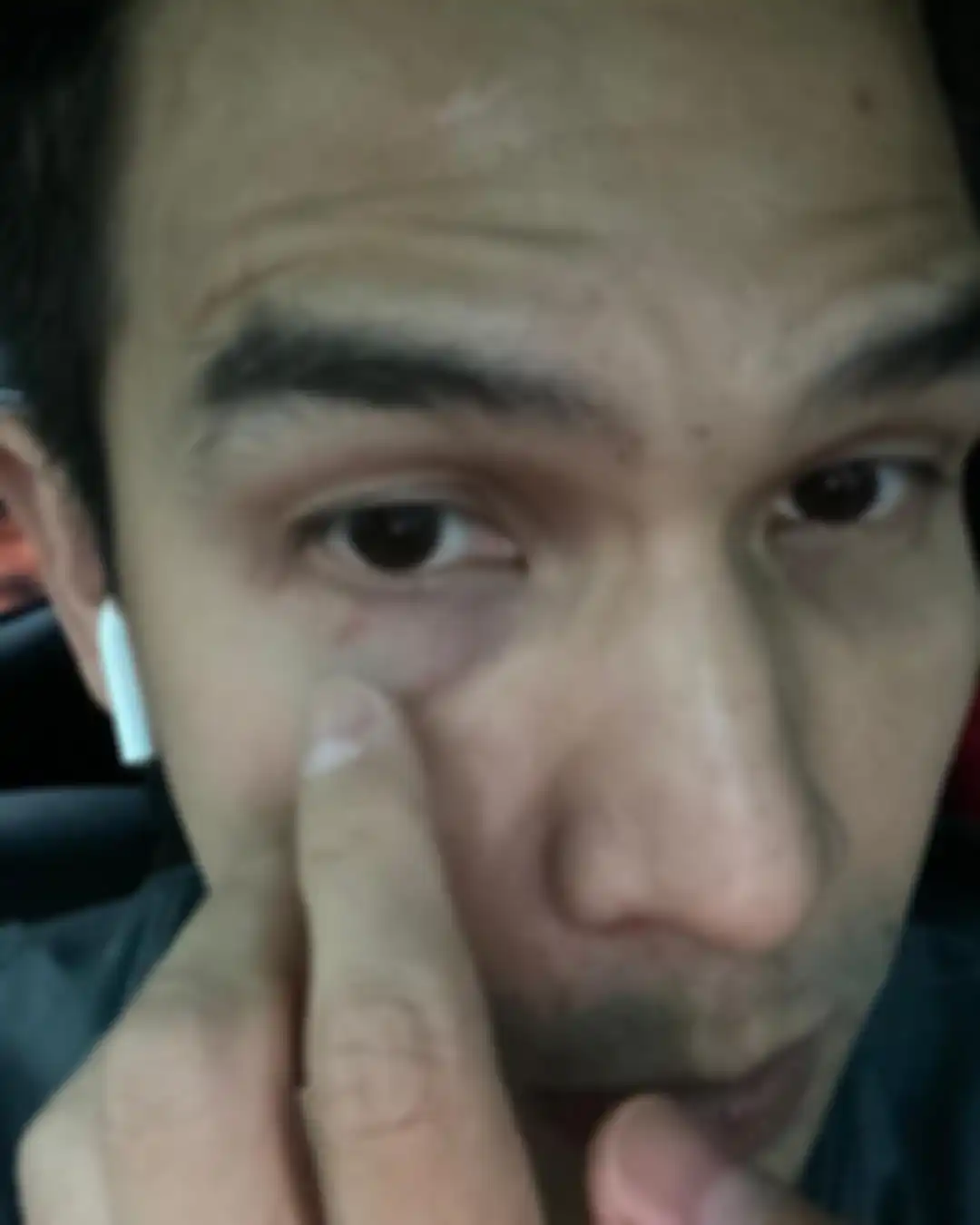 Paman Jonathan Frizzy, Benny Simanjuntak makin getol mengunggah foto bukti kekekasan Dhena Devanka di Instagram. 