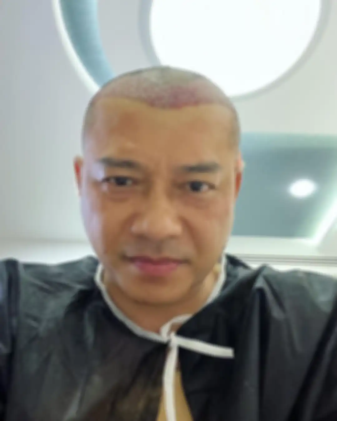 Anang Hermansyah mengunggah foto kepala plontos di media sosial. 