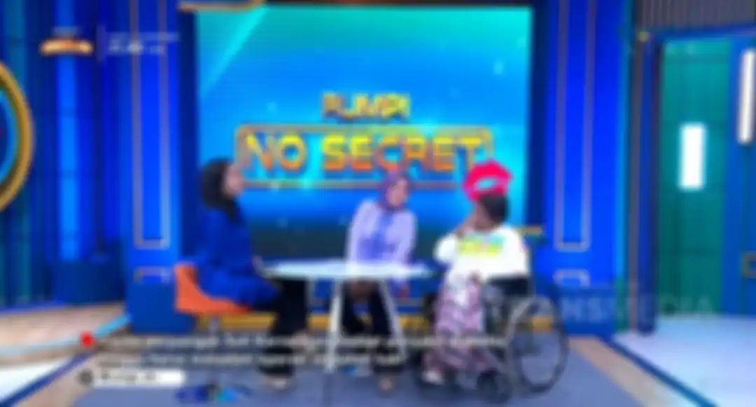 Suti Karno ungkap kakinya diamputasi