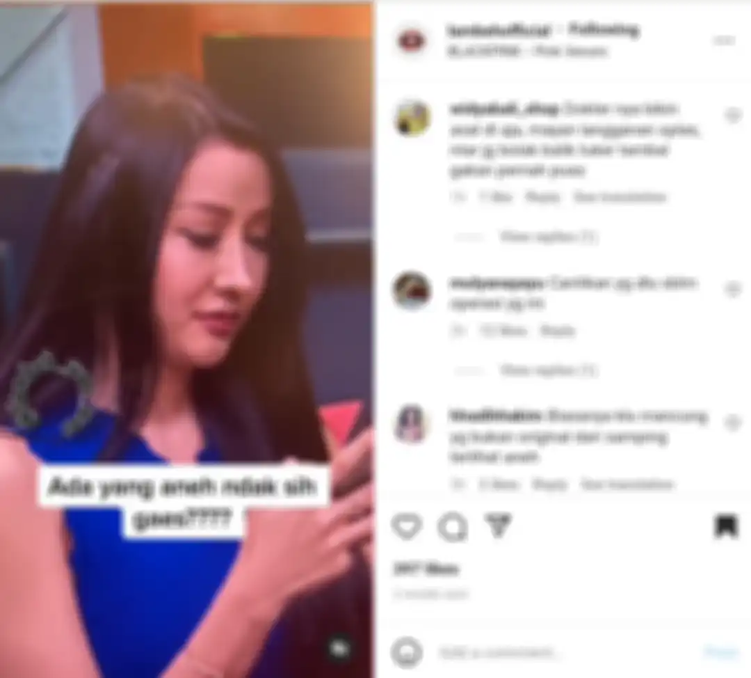 Wajah Lucinta Luna disorot setelah operasi plastik.