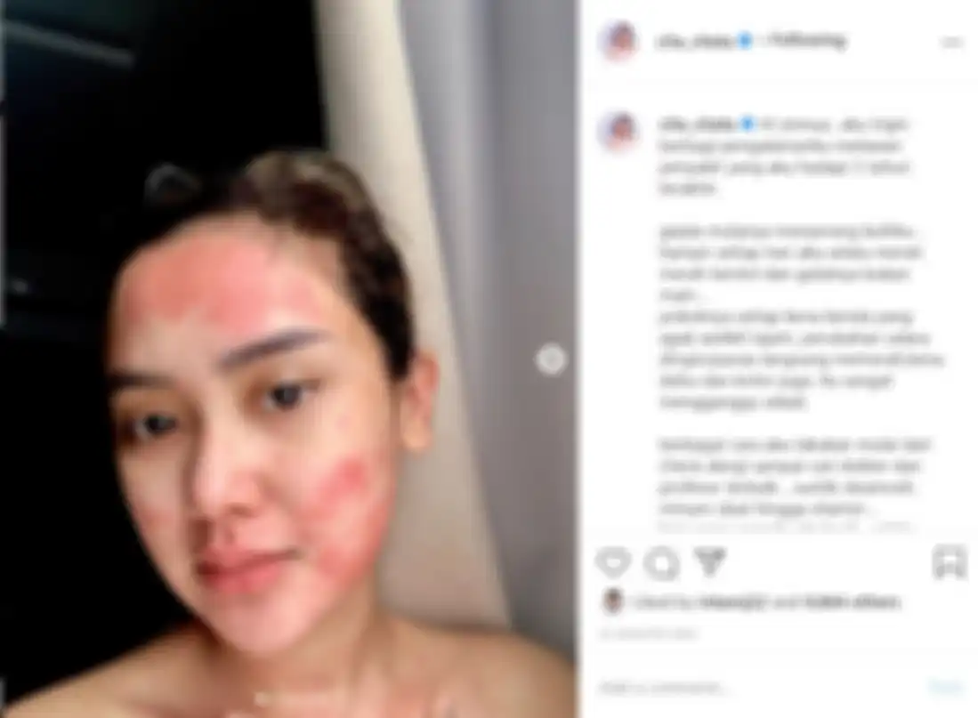 Cita Citata mengungkap penyakit yang telah lima tahun diidapnya.