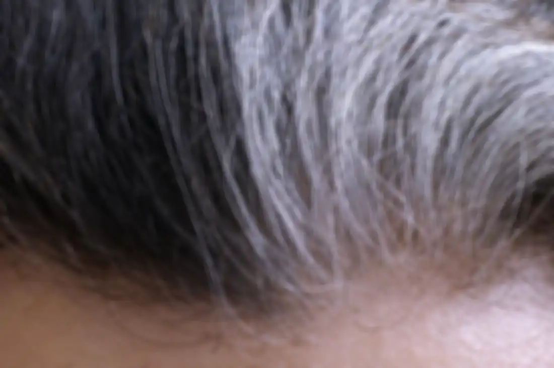 Rambut beruban
