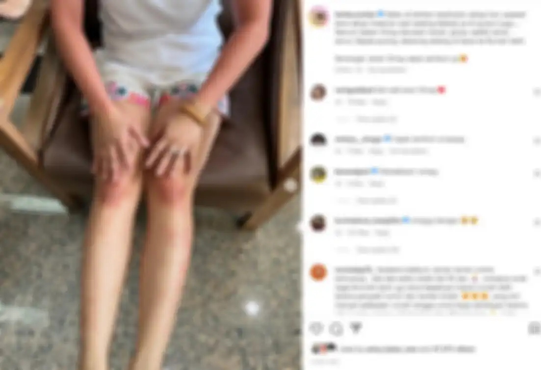 Food Vlogger Farida Nurhan keracunan makanan
