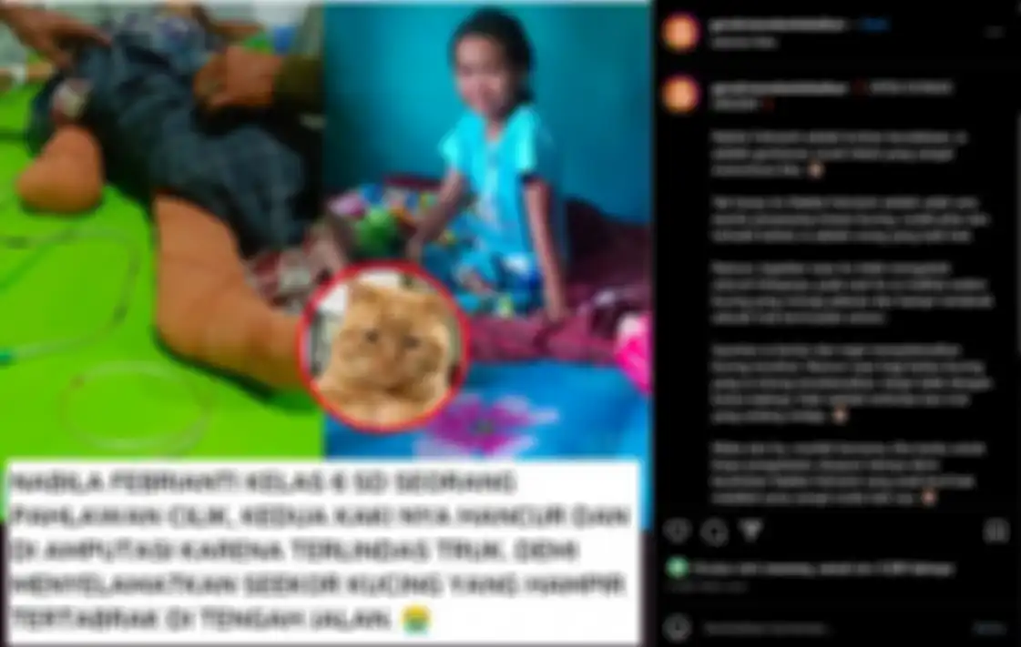 Kisah viral, siswi SD diamputasi kakinya setelah menyelamatkan kucing.