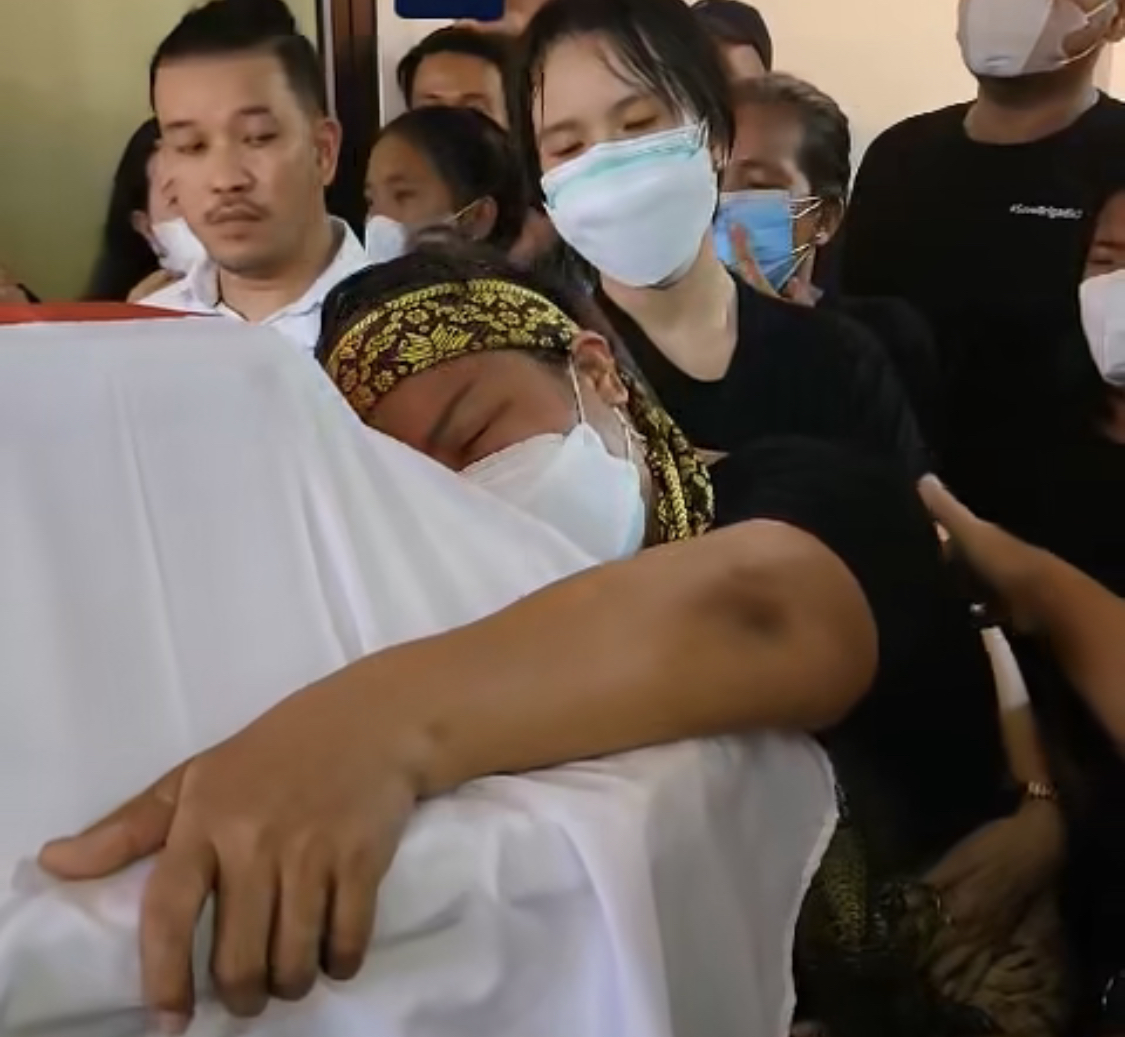 Ahli forensik punya jawaban pamungkas begini ketika bekas jerat tali di leher Brigadir J dipatahkan autopsi ulang. Foto jenazah Yosua diunggah.
