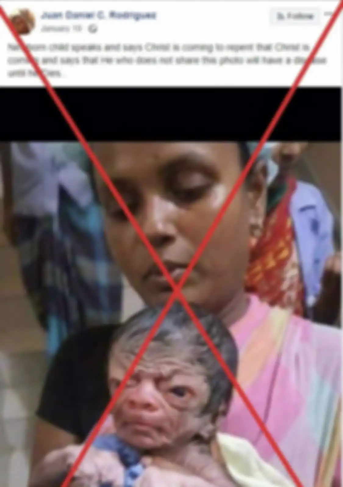 Bayi yang baru lahir memiliki kelainan. Wajahnya seperti kakek usia 80 tahun. Bayi ini juga disebut bawa pesan dari nabi. Begini fakta sebenarnya. 