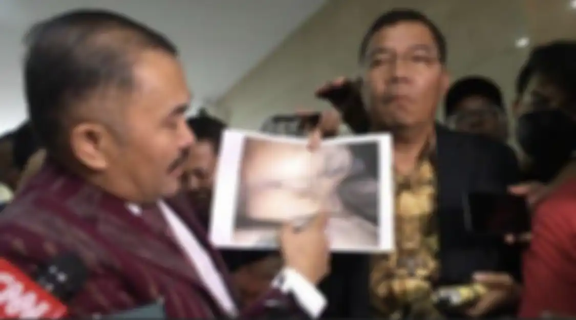 Tangan kanan Kapolri, Irjen Dedi Prasetyo sampai respons begini saat pengacara keluarga Brigadir Yosua umbar fakta sensitif setiap hari.