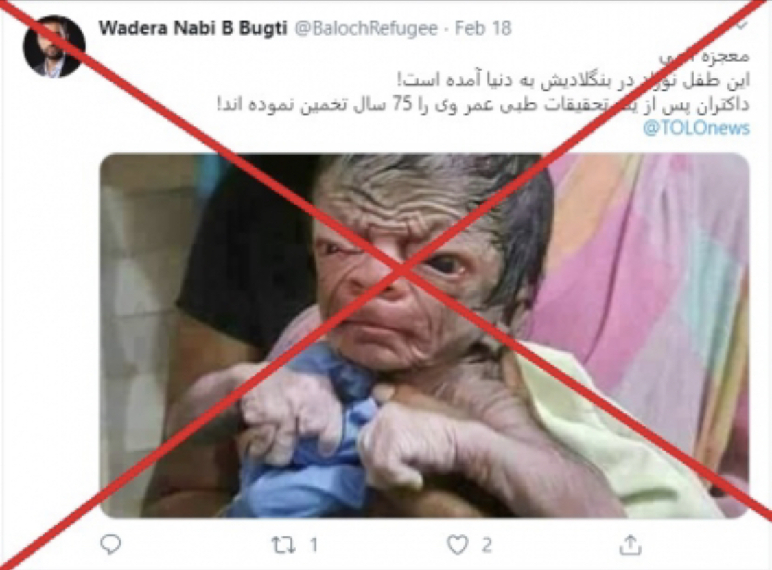 Bayi yang baru lahir memiliki kelainan. Wajahnya seperti kakek usia 80 tahun. Bayi ini juga disebut bawa pesan dari nabi. Begini fakta sebenarnya. 