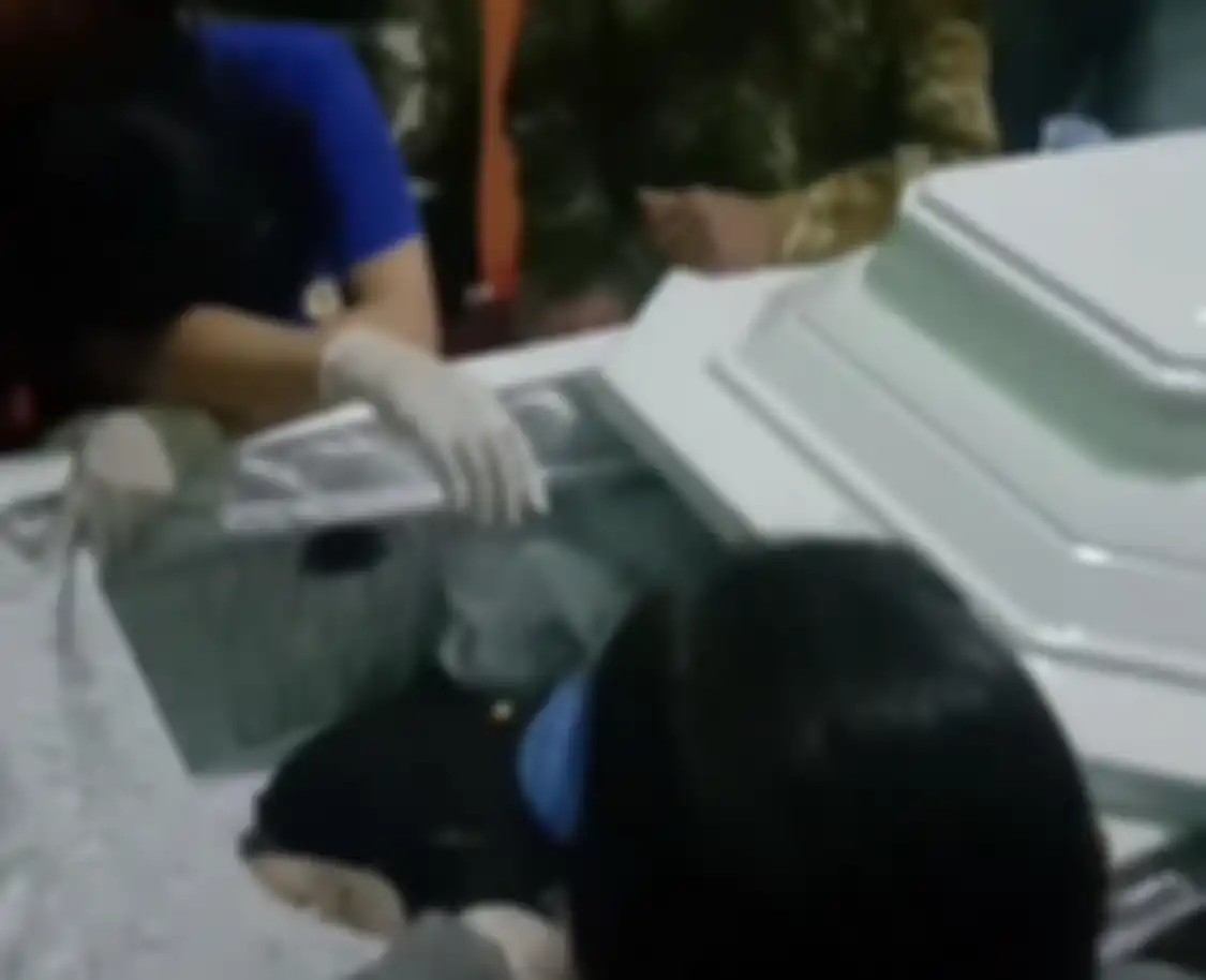 Para wanita ini disebut nekat membuka baju Brigadir Yosua ketika polisi lengah. Wanita syok temukan banyak luka sayatan dan jahitan.