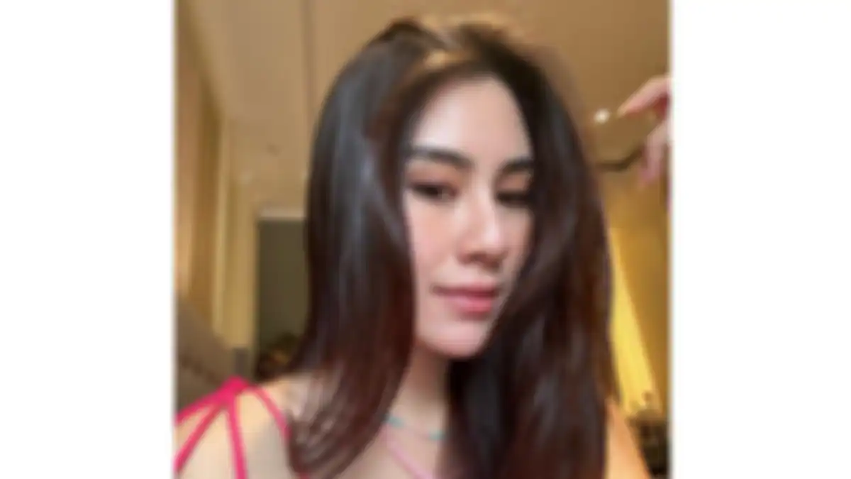 Syahnaz diduga lakukan operasi plastik