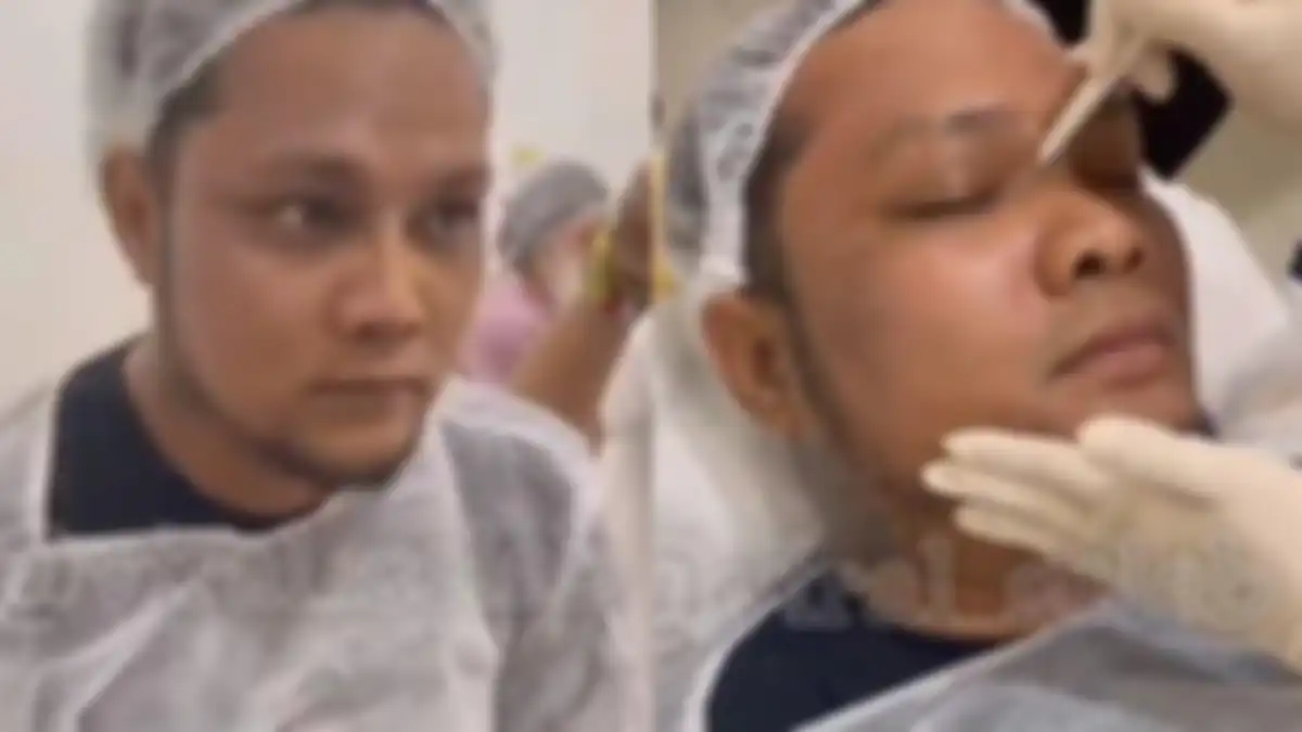 Penampilan baru Virgoun usai permak hidung. 