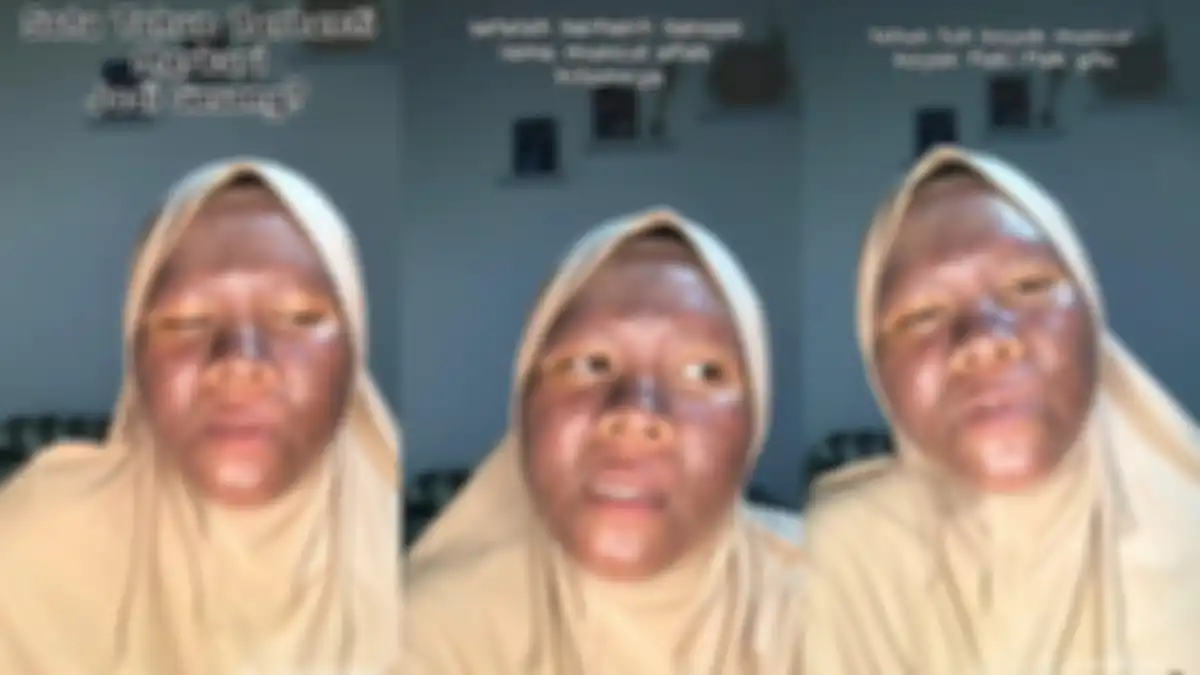 Ternyata penyebab wajah gadis ini gosok gegara pakai krim pemutih mengandung merkuri.