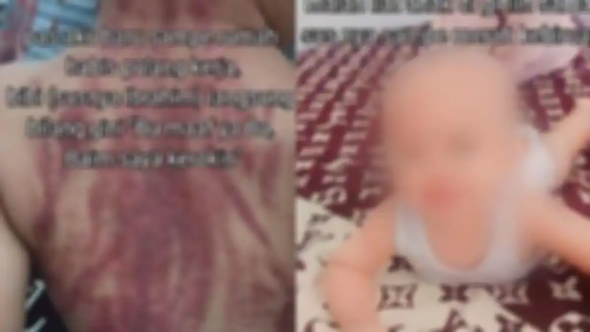 ASTAGFIRULLAH curhatan pilu ibu syok lihat bayinya umur 13 bulan dikeroki pengasuh sampai kulit merah, putuskan maafkan pelaku.