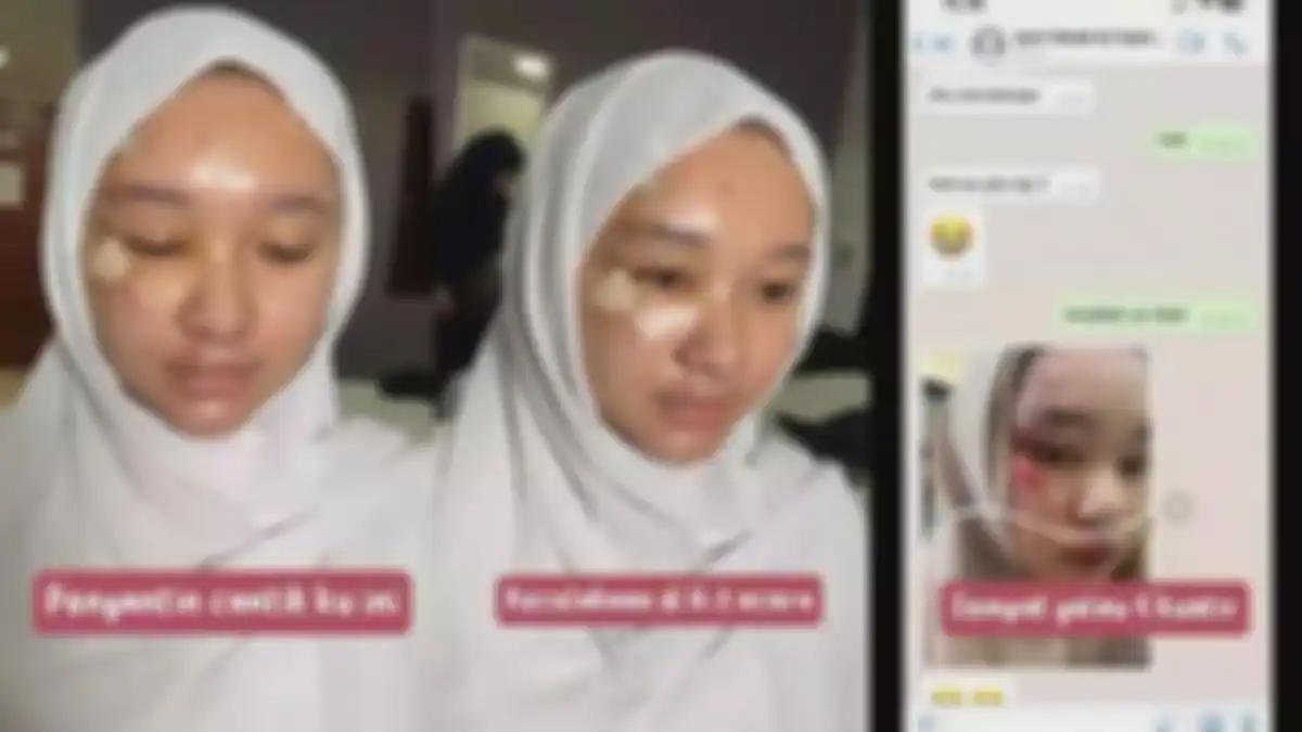 Pengantin alami kecelakaan H-3 pernikahan.