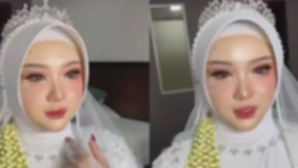 Pengantin wanita alami kecelakaan H-3 pernikahan.