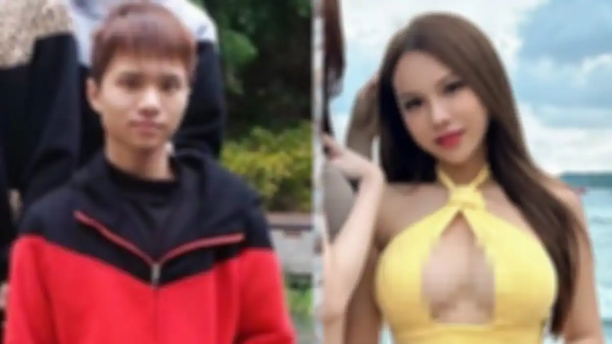 Penampilan YouTuber asal Taiwan, Ala atau Xiao A La usai jalani operasi plastik.  
