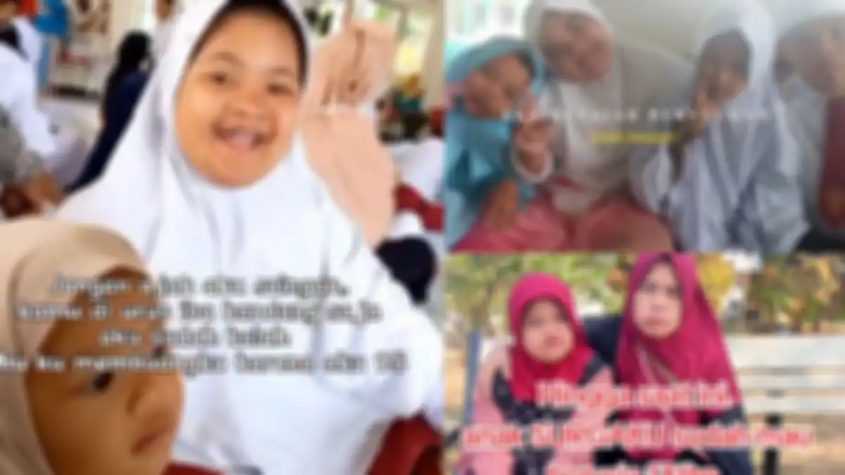 Bibi Nuy, bocah down syndrome yang dirawat istri pertama ayahnya 