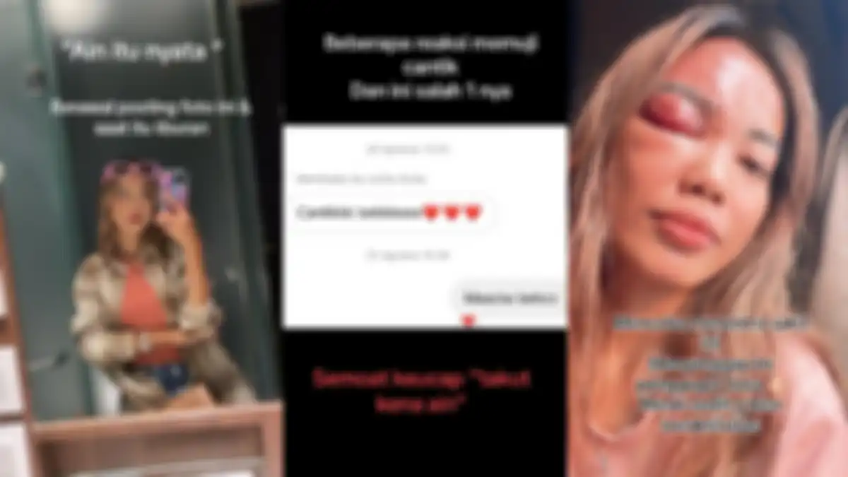 Wanita menduga terkena penyakit ain buntut posting foto lalu banyak dipuji cantik.