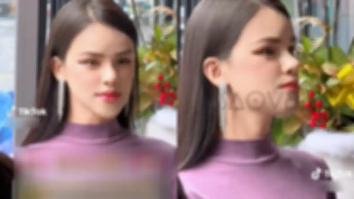 Seleb TikTok pria jalani operasi demi bisa jadi wanita cantik. 