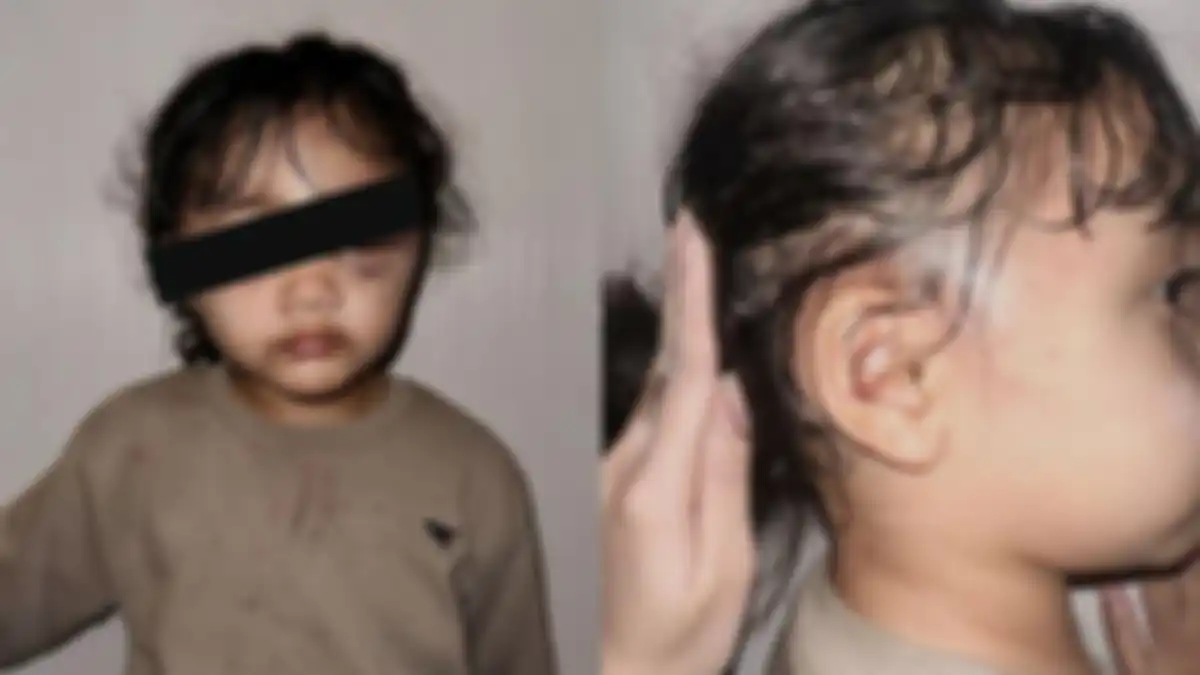 Anak Aghnia Punjabi dianiaya pengasuh 