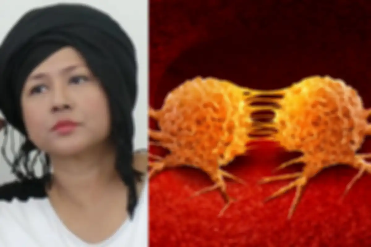 Sel kanker pada tubuh Ria Irawan mengalami metastasis