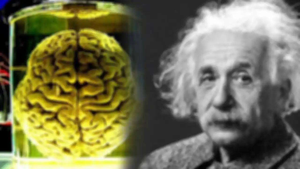 Otak Albert Einstein
