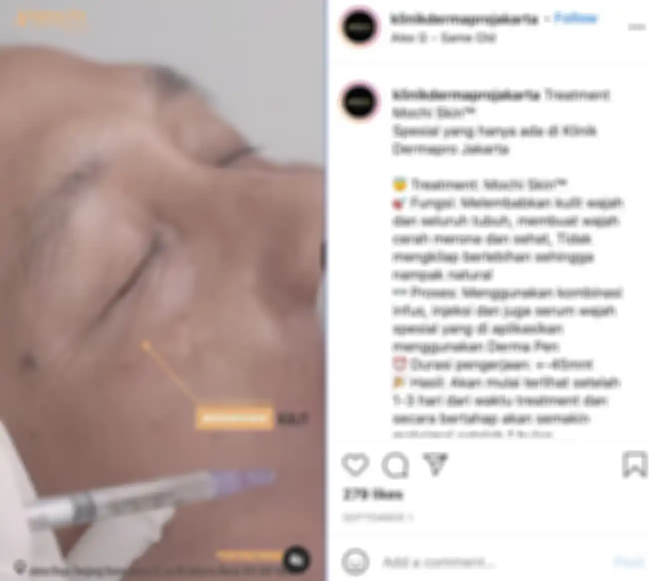 Ayah Rozak lakukan perawatan dan tanam benang
