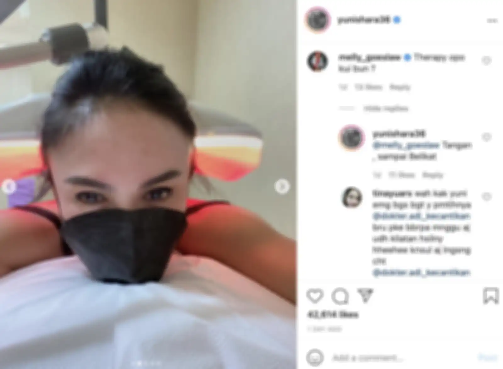 Kondisi Yuni Shara saat menjalani terapi