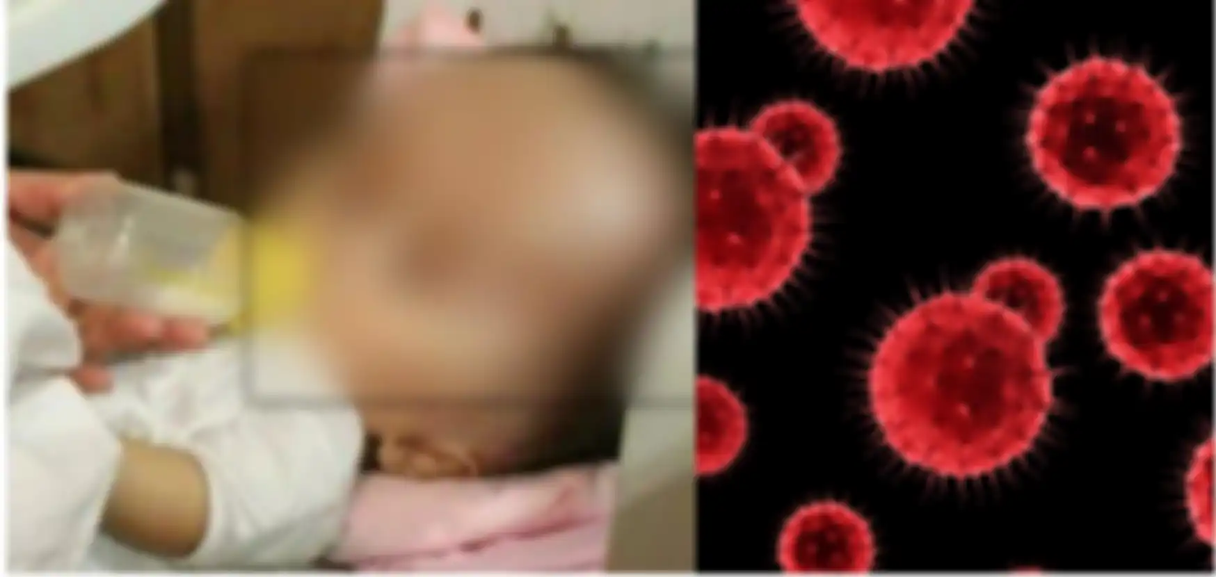 Cerita pilu seorang ayah yang jadi pengangguran semenjak pandemi Covid-19 dan harus berjuang mengobati sang anak yang menderita penyakit hidrosefalus.