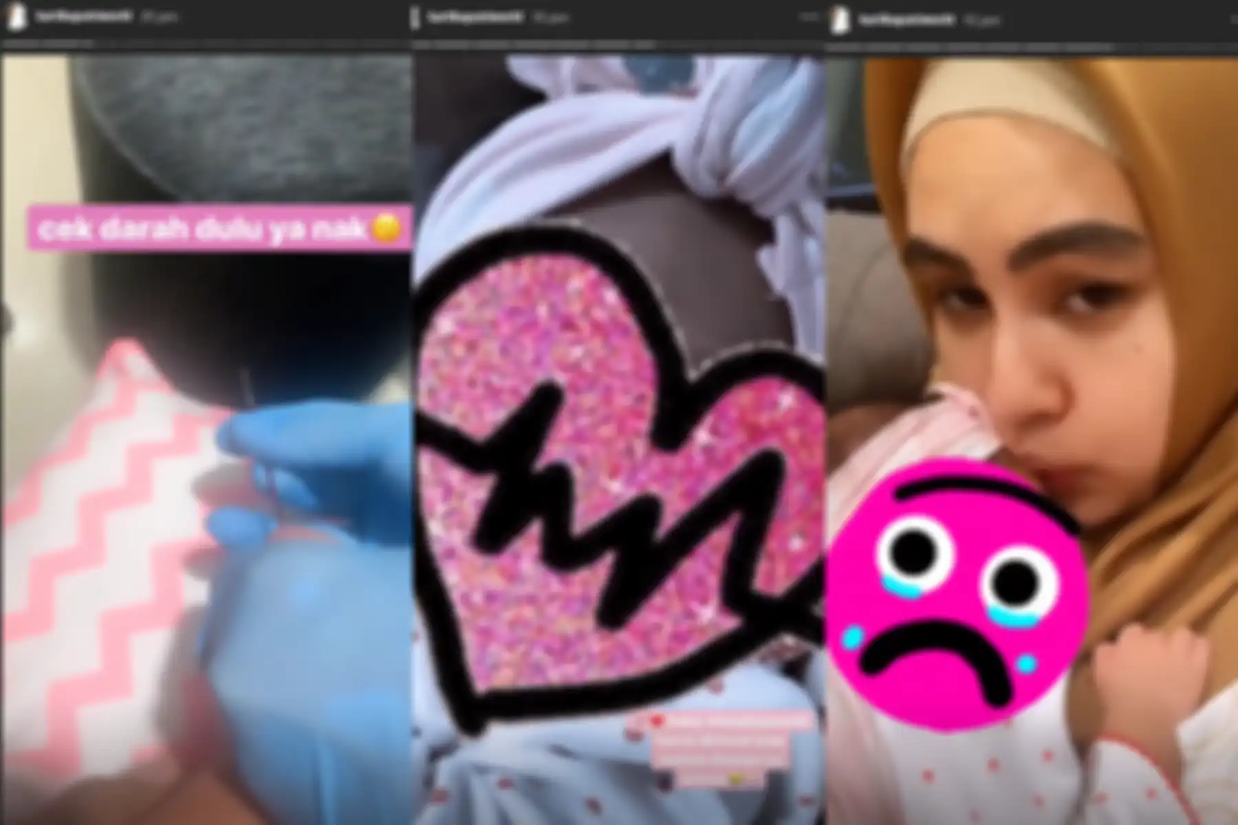 Alami masalah kesehatan, bayi Kartika Putri harus dirawat inap