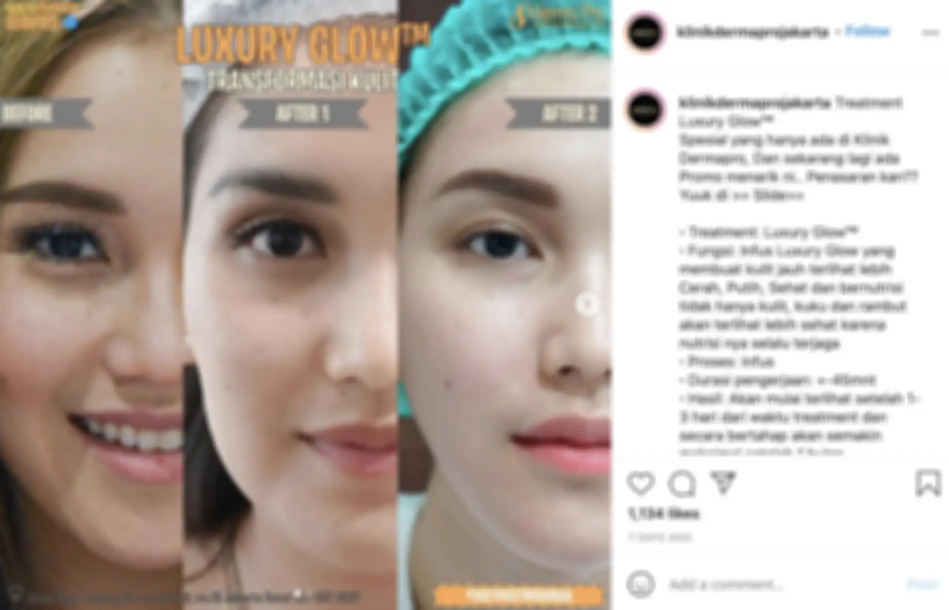 Perubahan wajah Ayu Ting Ting setelah perawatan