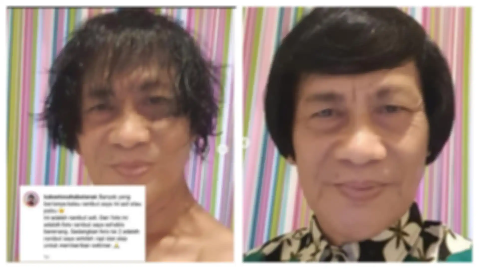 Sering dikira rambut palsu, Kak Seto angkat suara