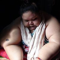 Pemadam Kebakaran Sampai Bobol Pintu dan Jendela untuk Angkat Dirinya, Titi Wati Bersiap untuk Jalani Operasi Ini