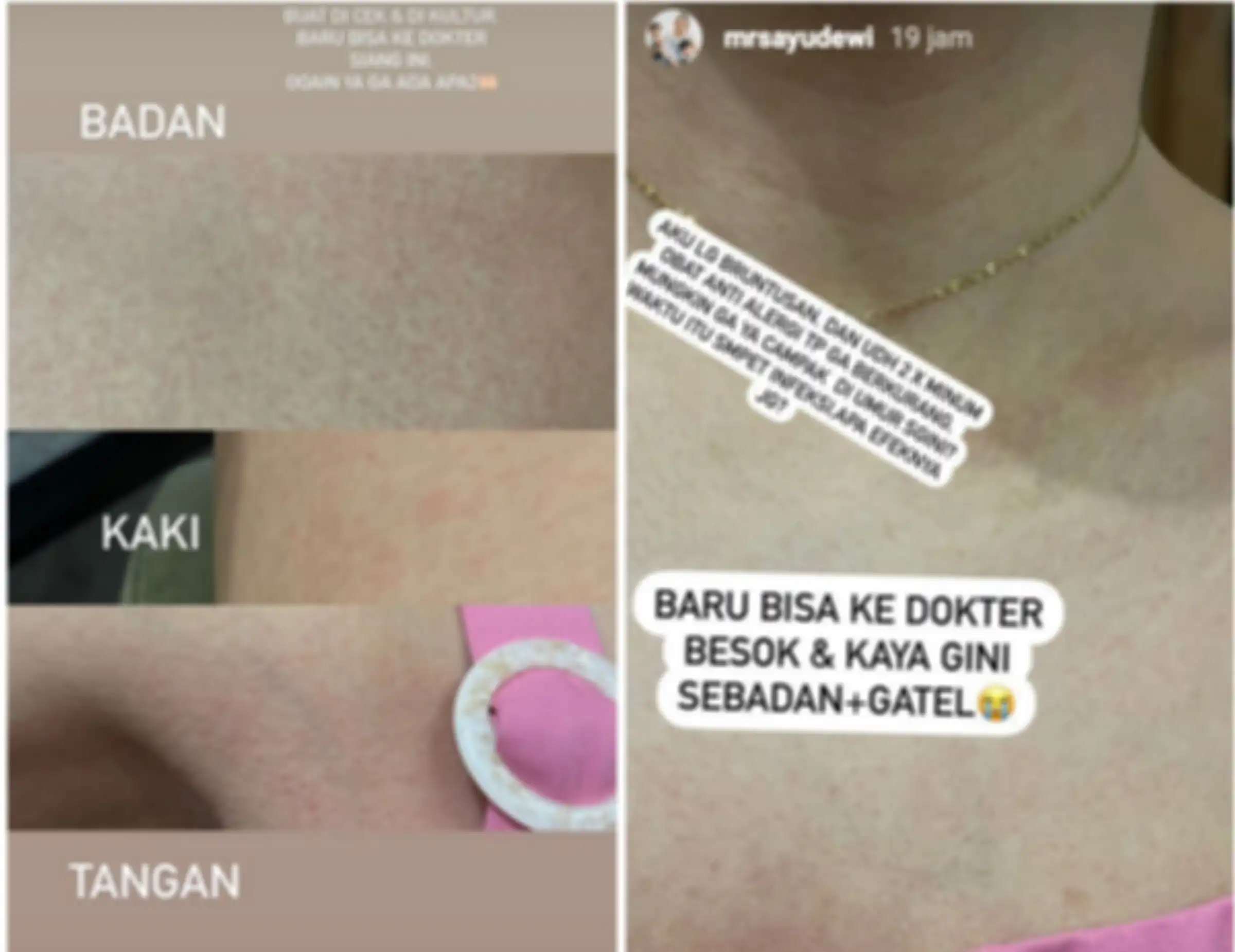 Kondisi Ayu Dewi