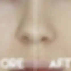 Begini Cara Menyamarkan Pori-pori Besar Dengan Makeup, Ikuti Girls