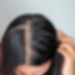 5 Makanan yang Bisa Bikin Rambut Tipis, Sebaiknya Kontrol Saat Makan