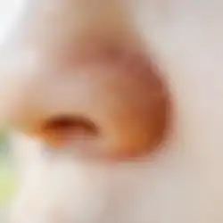 8 Cara Hilangkan Kulit Kering dan Bersisik di Area Hidung, Pasti Ampuh