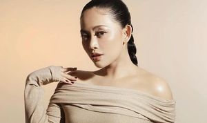 Kuasa Hukum Buka Suara soal Isu KDRT Rachel Vennya Usai Unggahan Foto Wajah Diduga Lebam Viral