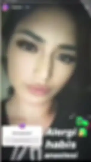 Wajah iritasi Jedar setelah ditutupi foundation