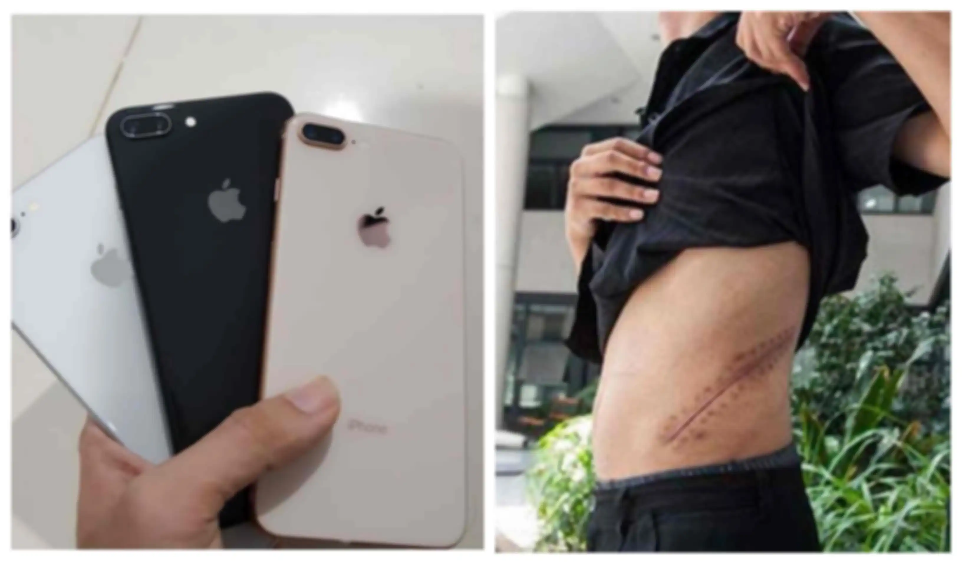 Ilustrasi jual ginjal untuk membeli iPhone.