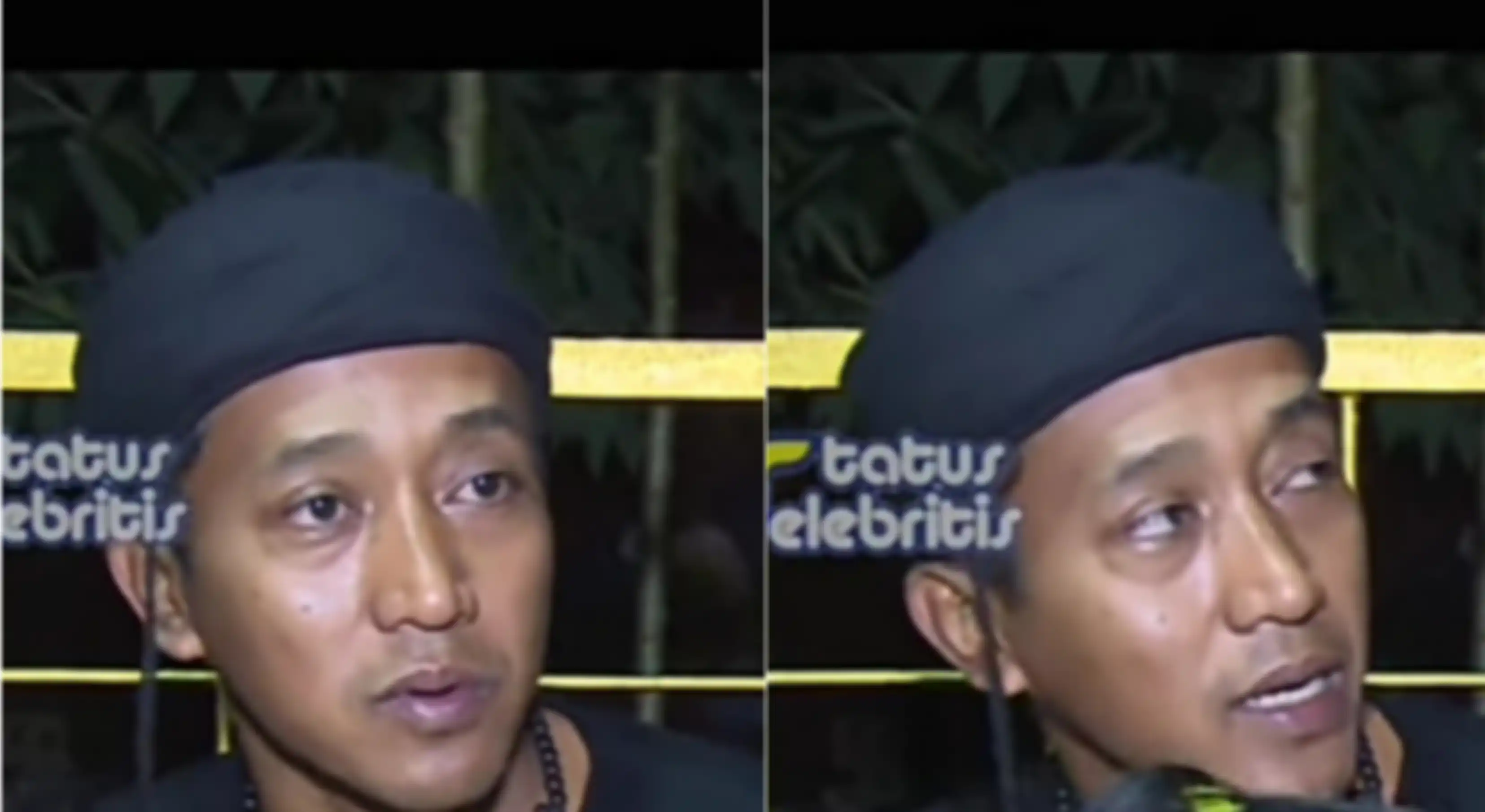 Kondisi Teddy Pardiyana