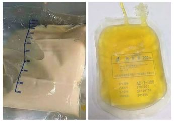 Darah Pasien Sembuh Covid-19 Sudah ada yang Jual Dengan Harga Fantastis, untuk Obat Virus Corona Rp300 Juta