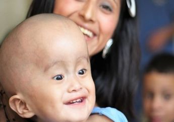 Mengenal Hydrocephalus pada Bayi : Penyebab, Gejala, dan Pengobatannya